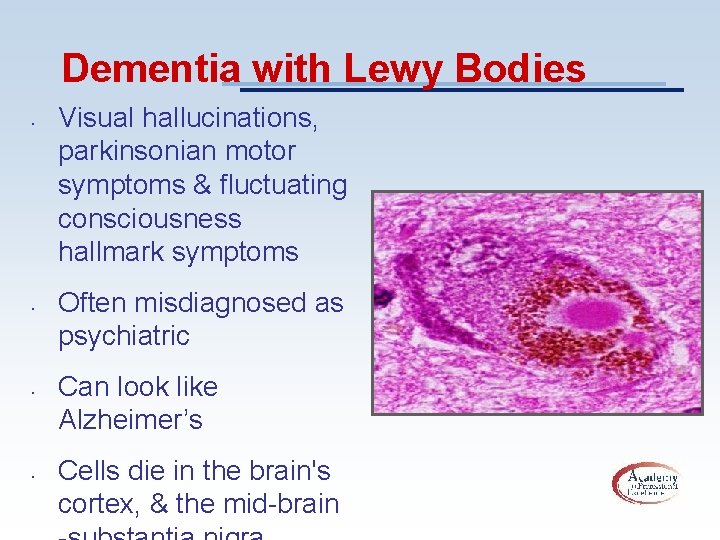 Dementia with Lewy Bodies • • Visual hallucinations, parkinsonian motor symptoms & fluctuating consciousness