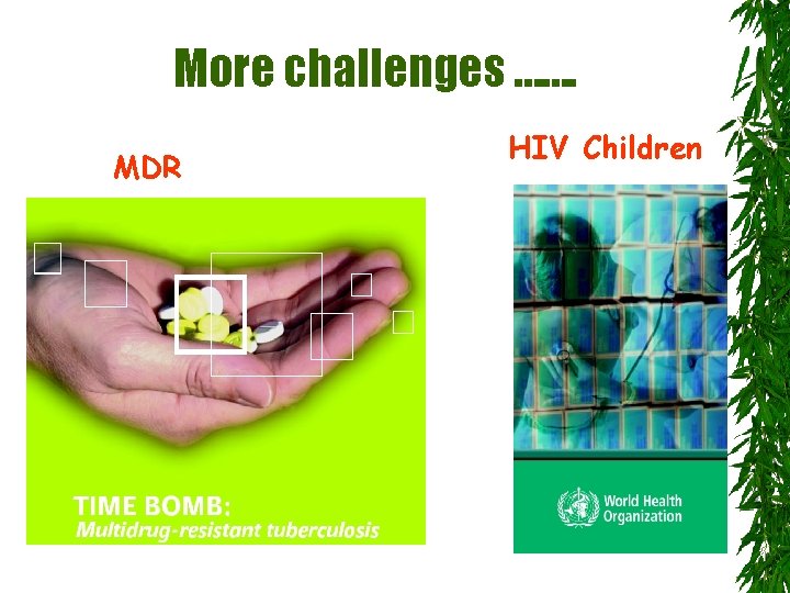More challenges ……. MDR HIV Children 
