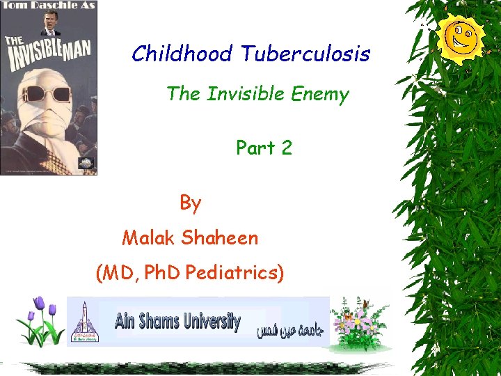 Childhood Tuberculosis The Invisible Enemy Part 2 By Malak Shaheen (MD, Ph. D Pediatrics)