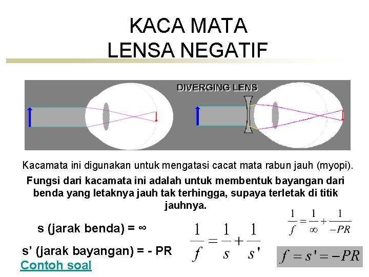 KACA MATA LENSA NEGATIF Kacamata ini digunakan untuk mengatasi cacat mata rabun jauh (myopi).