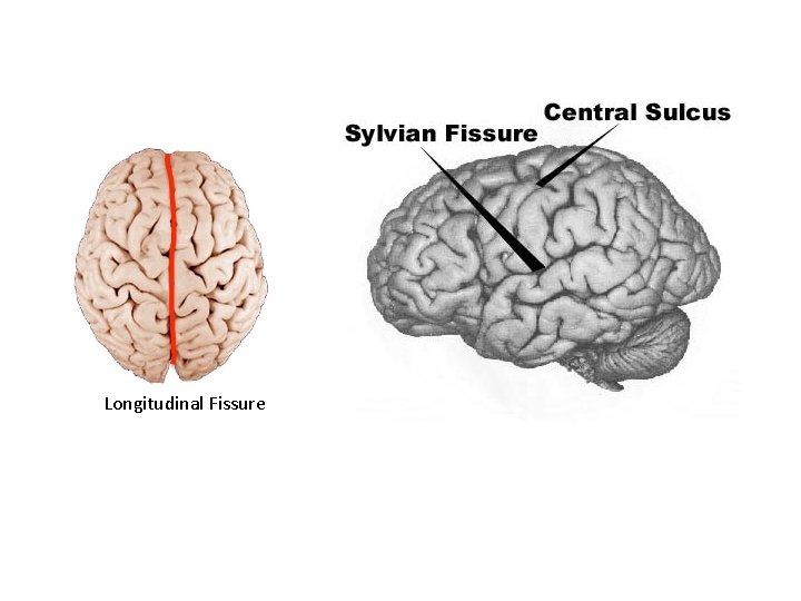 Longitudinal Fissure 