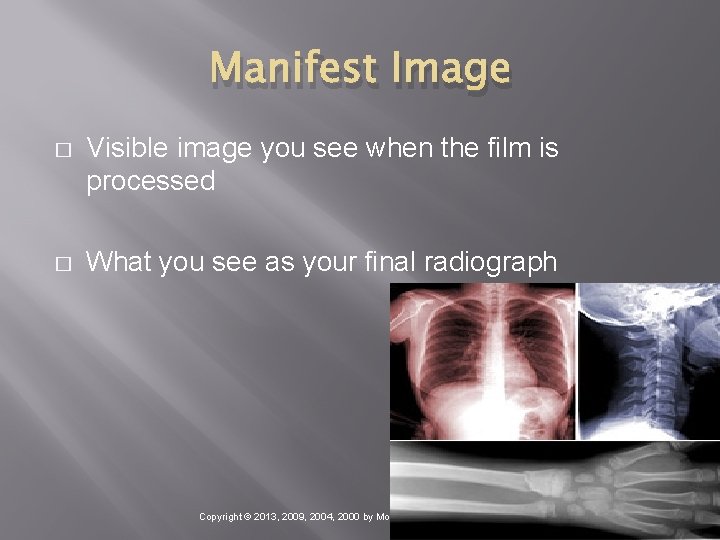 Manifest Image � Visible image you see when the film is processed � What