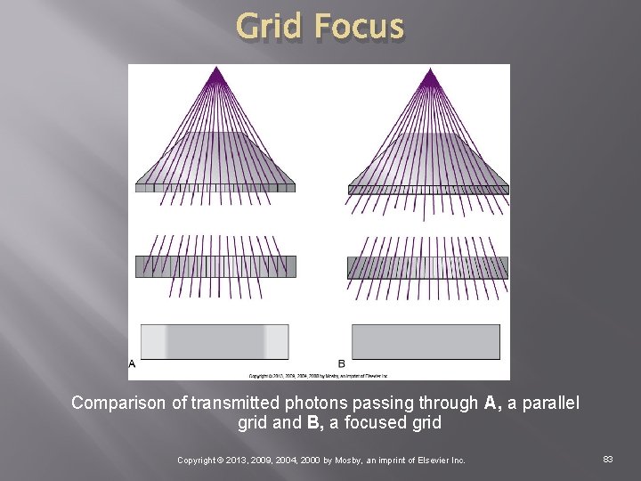 Grid Focus Comparison of transmitted photons passing through A, a parallel grid and B,