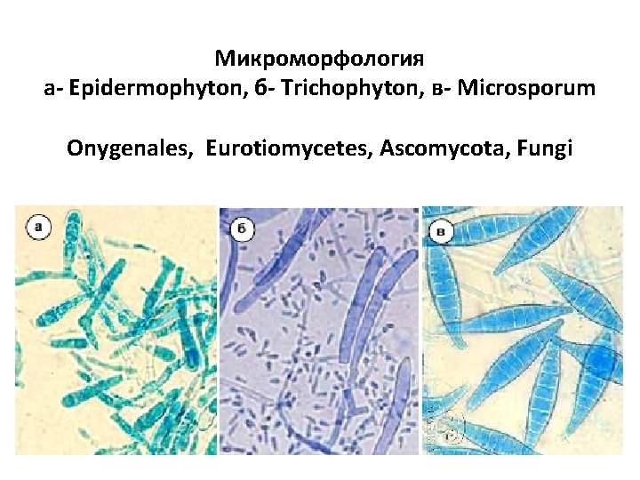 Микроморфология а- Epidermophyton, б- Trichophyton, в- Microsporum Onygenales, Eurotiomycetes, Ascomycota, Fungi 