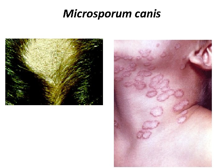 Microsporum canis 