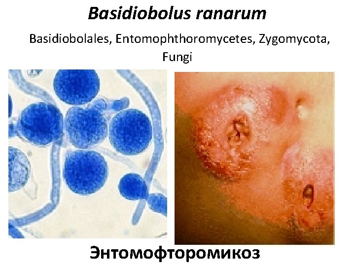 Basidiobolus ranarum Basidiobolales, Entomophthoromycetes, Zygomycota, Fungi Энтомофторомикоз 