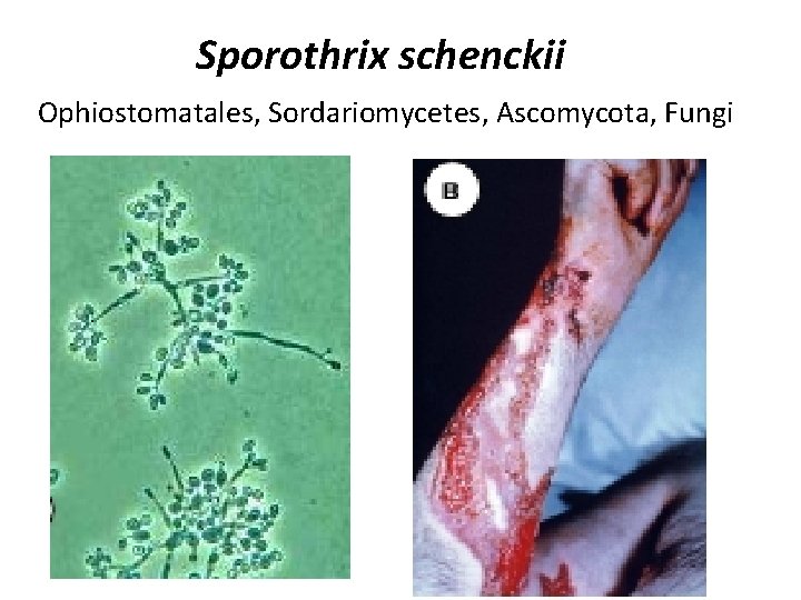 Sporothrix schenckii Ophiostomatales, Sordariomycetes, Ascomycota, Fungi 