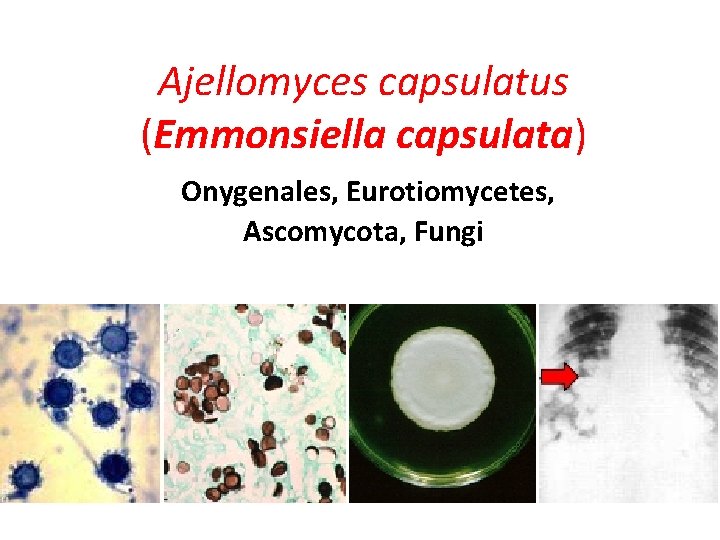 Ajellomyces capsulatus (Emmonsiella capsulata) Onygenales, Eurotiomycetes, Ascomycota, Fungi 