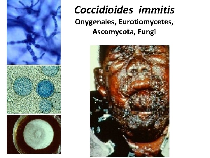 Coccidioides immitis Onygenales, Eurotiomycetes, Ascomycota, Fungi 