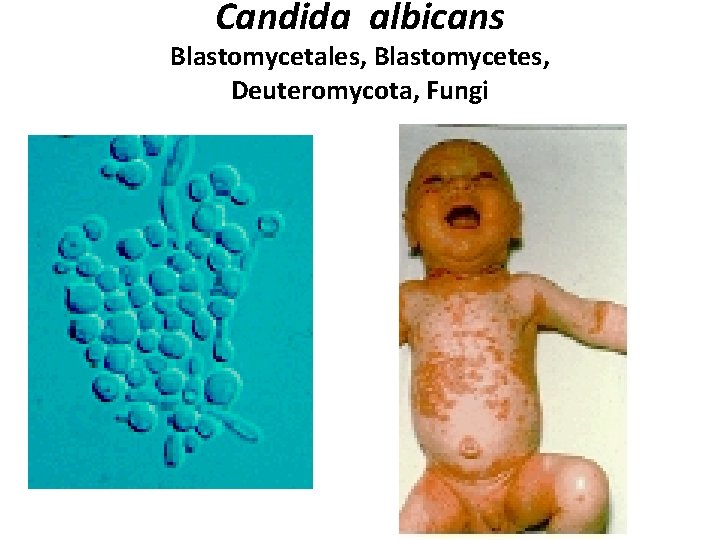 Candida albicans Blastomycetales, Blastomycetes, Deuteromycota, Fungi 