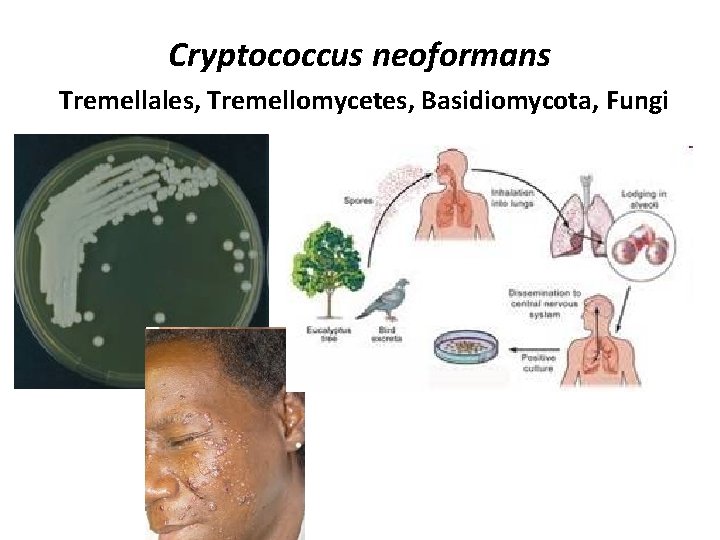 Cryptococcus neoformans Tremellales, Tremellomycetes, Basidiomycota, Fungi 
