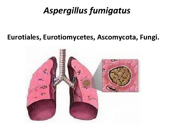 Aspergillus fumigatus Eurotiales, Eurotiomycetes, Ascomycota, Fungi. 