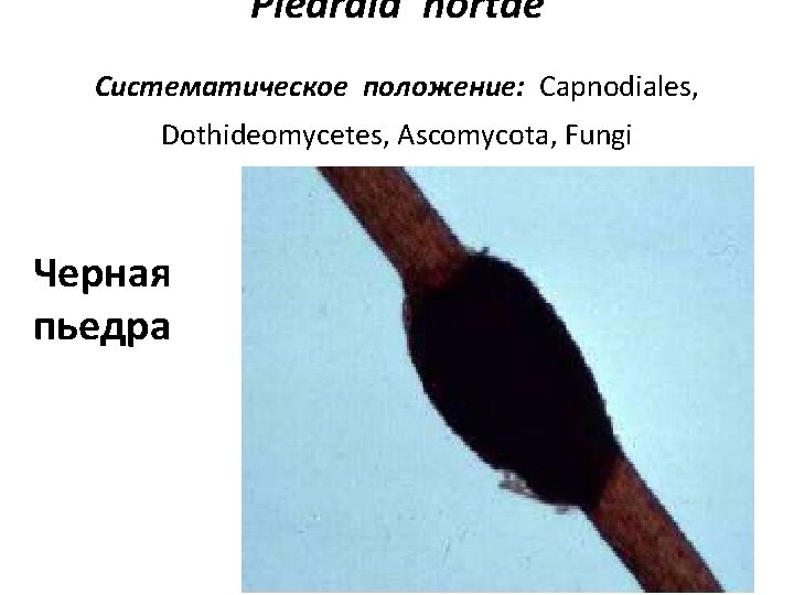 Piedraia hortae Систематическое положение: Capnodiales, Dothideomycetes, Ascomycota, Fungi Черная пьедра 