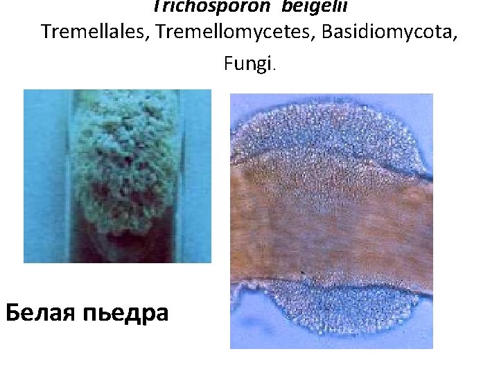 Trichosporon beigelii Tremellales, Tremellomycetes, Basidiomycota, Fungi. Белая пьедра 