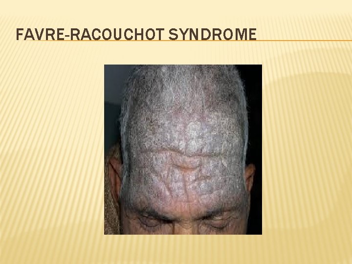 FAVRE-RACOUCHOT SYNDROME 