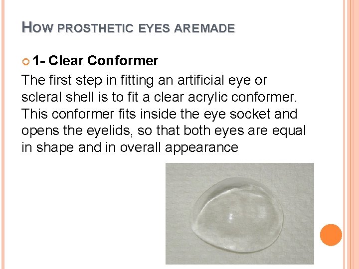 HOW PROSTHETIC EYES ARE MADE 1 - Clear Conformer The first step in fitting