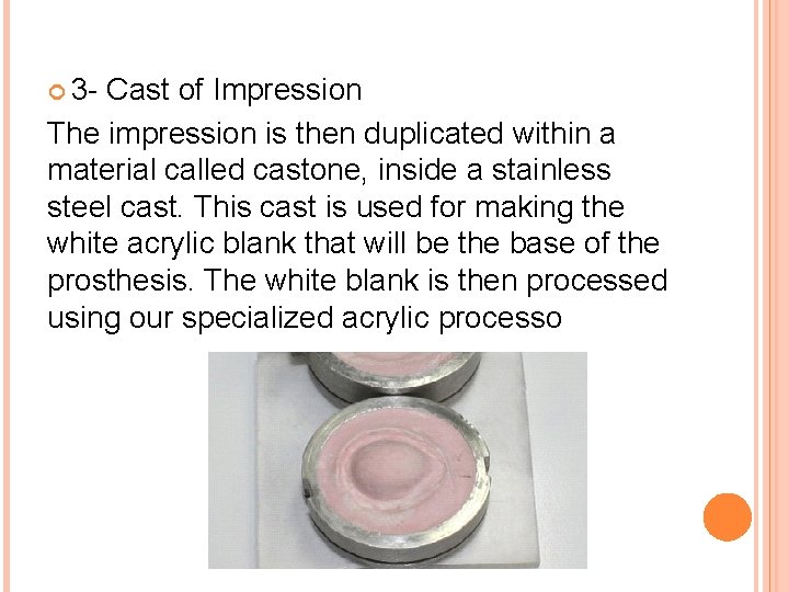  3 - Cast of Impression The impression is then duplicated within a material