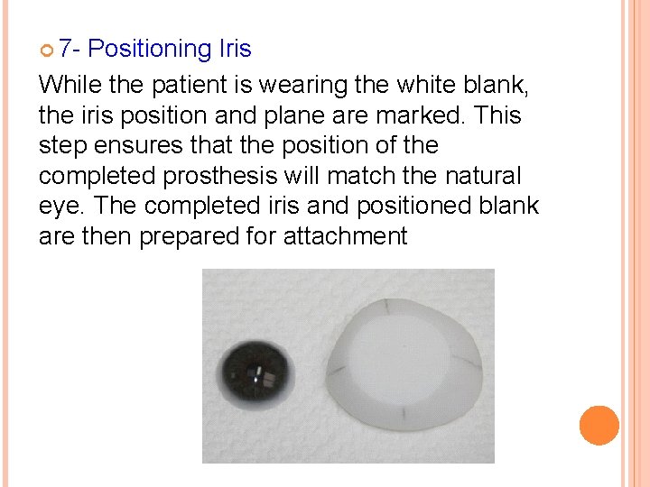  7 - Positioning Iris While the patient is wearing the white blank, the