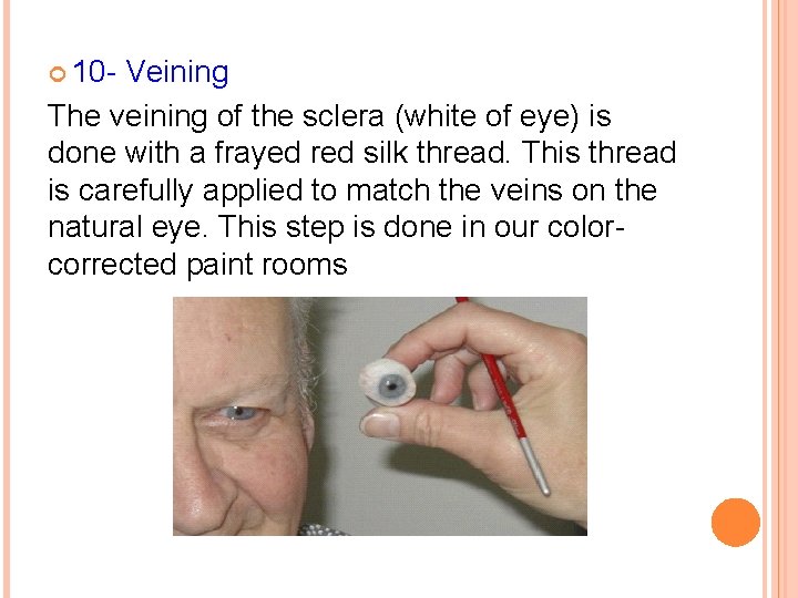  10 - Veining The veining of the sclera (white of eye) is done