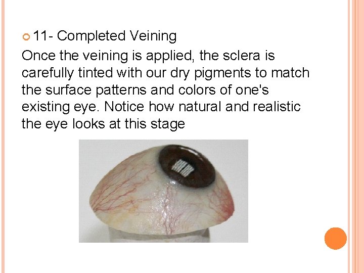  11 - Completed Veining Once the veining is applied, the sclera is carefully