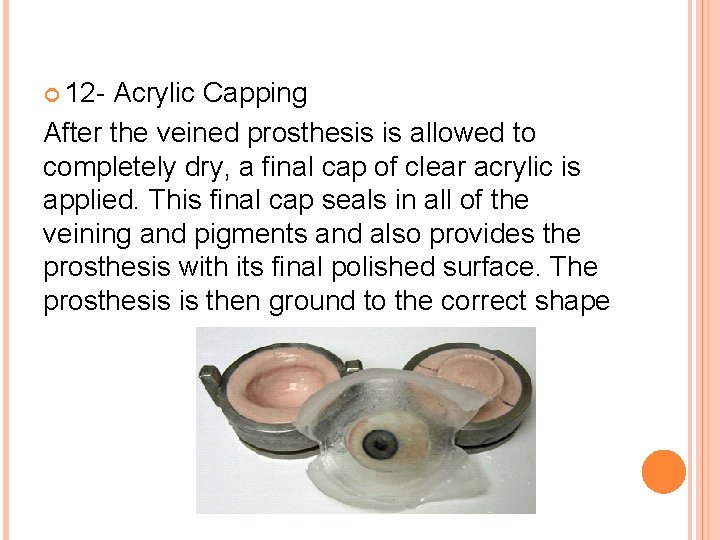  12 - Acrylic Capping After the veined prosthesis is allowed to completely dry,