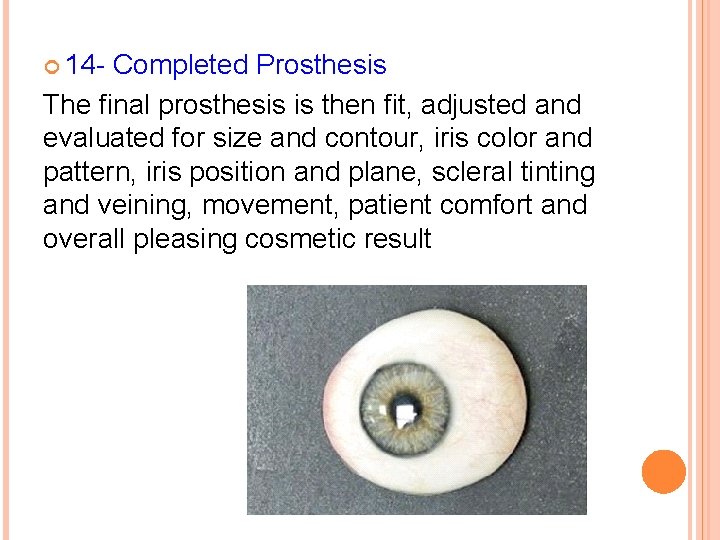  14 - Completed Prosthesis The final prosthesis is then fit, adjusted and evaluated