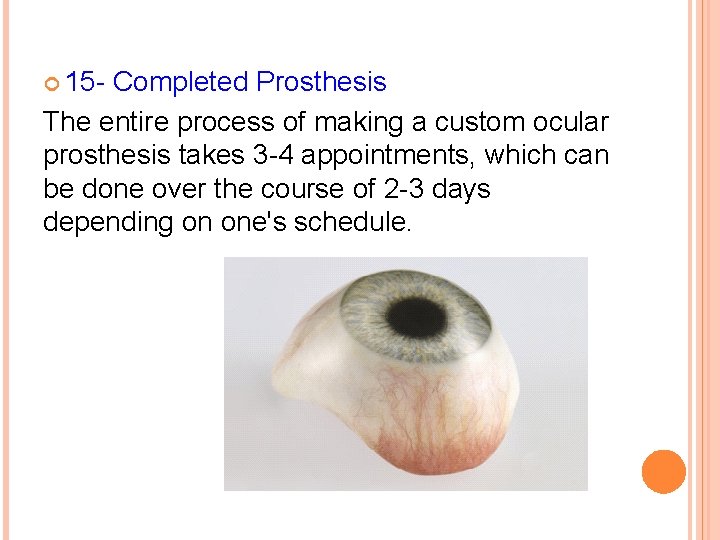  15 - Completed Prosthesis The entire process of making a custom ocular prosthesis