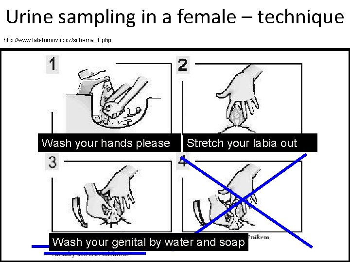 Urine sampling in a female – technique http: //www. lab-turnov. ic. cz/schema_1. php Wash