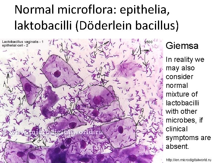 Normal microflora: epithelia, laktobacilli (Döderlein bacillus) Giemsa In reality we may also consider normal