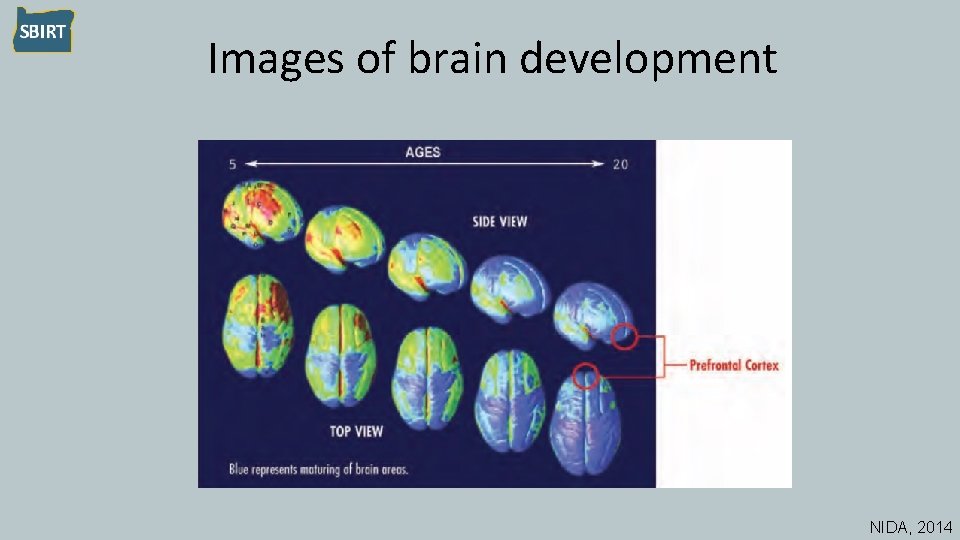 Images of brain development NIDA, 2014 