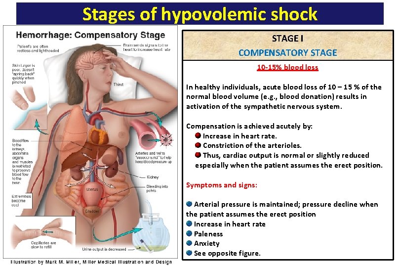 Stages of hypovolemic shock STAGE I COMPENSATORY STAGE 10 -15% blood loss In healthy