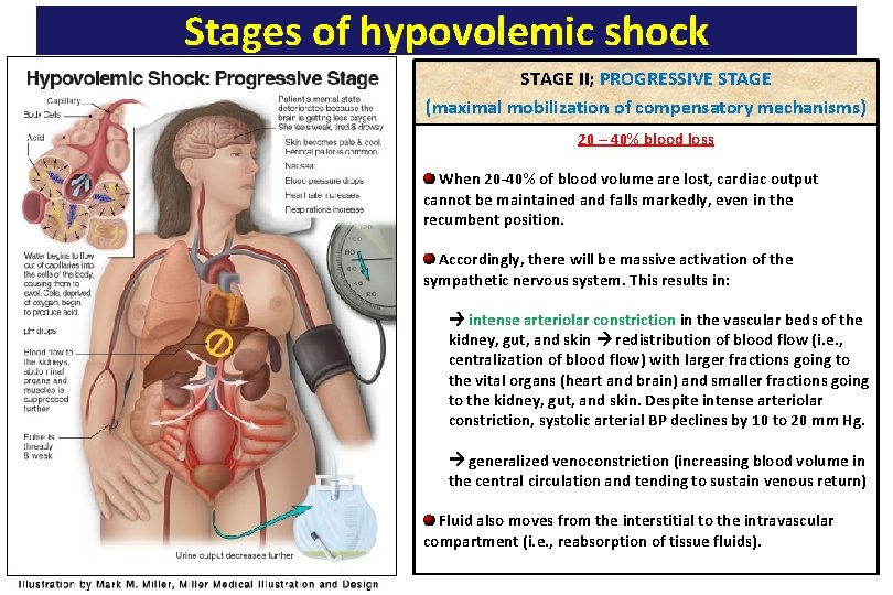 Stages of hypovolemic shock STAGE II; PROGRESSIVE STAGE (maximal mobilization of compensatory mechanisms) 20