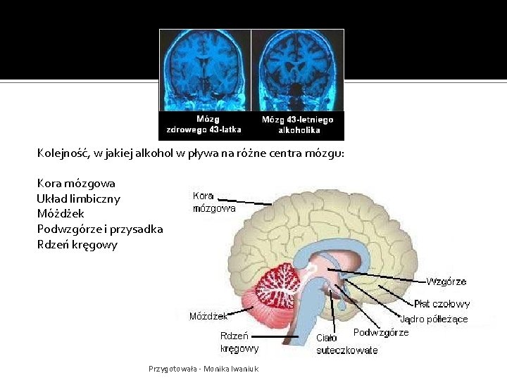 Kolejność, w jakiej alkohol w pływa na różne centra mózgu: Kora mózgowa Układ limbiczny