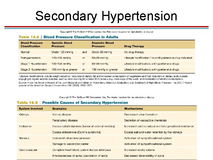 Secondary Hypertension 