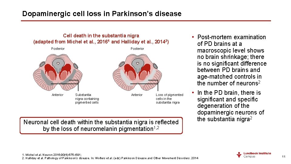 Dopaminergic cell loss in Parkinson’s disease Cell death in the substantia nigra (adapted from