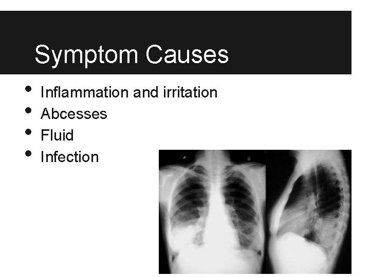 Symptom Causes • • Inflammation and irritation Abcesses Fluid Infection 