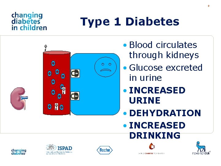 8 Type 1 Diabetes • Blood circulates through kidneys • Glucose excreted in urine