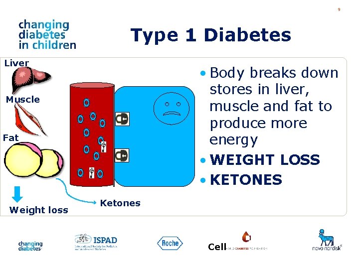 9 Type 1 Diabetes Liver • Body breaks down stores in liver, muscle and