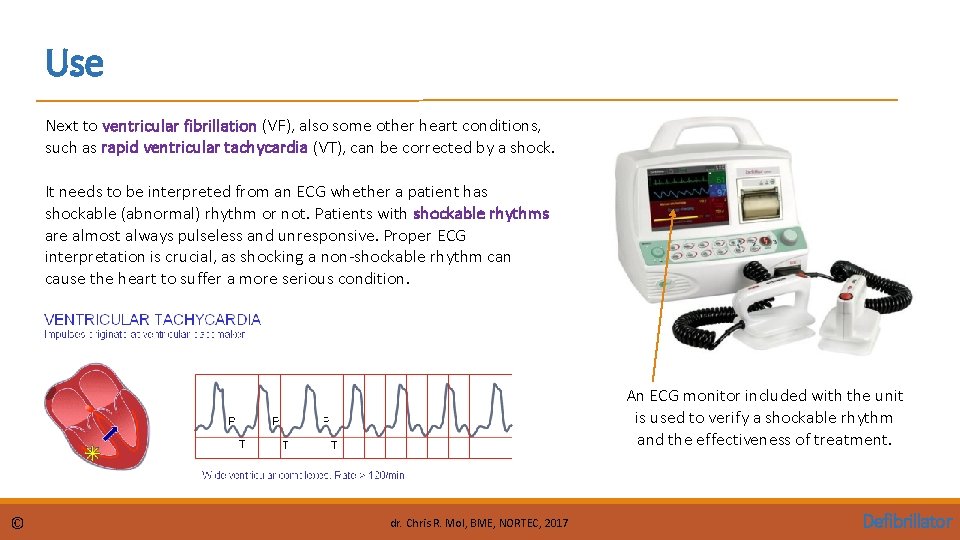 Use Next to ventricular fibrillation (VF), also some other heart conditions, such as rapid