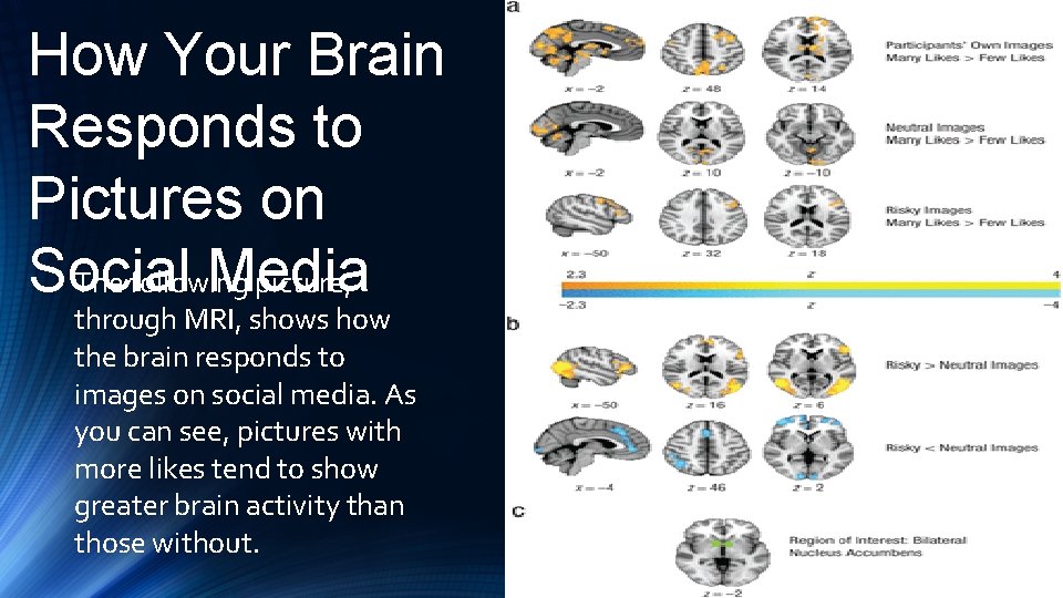 How Your Brain Responds to Pictures on Social Media The following picture, through MRI,