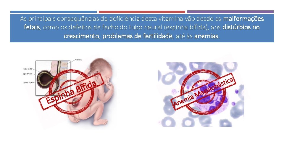 As principais consequências da deficiência desta vitamina vão desde as malformações fetais, como os