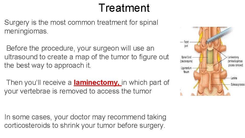 Treatment Surgery is the most common treatment for spinal meningiomas. Before the procedure, your