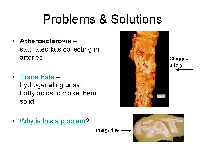 Problems & Solutions • Atherosclerosis – saturated fats collecting in arteries • Trans Fats
