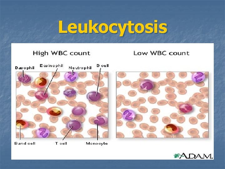 Leukocytosis 