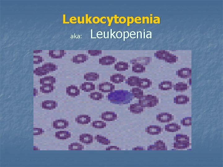 Leukocytopenia aka: Leukopenia 