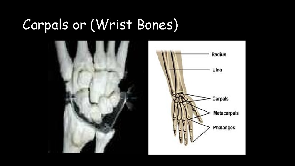 Carpals or (Wrist Bones) 