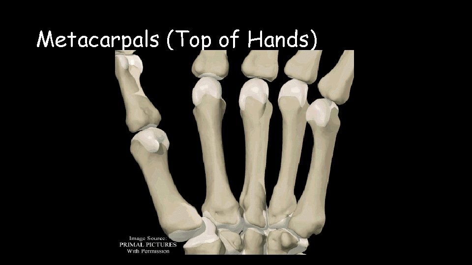 Metacarpals (Top of Hands) 