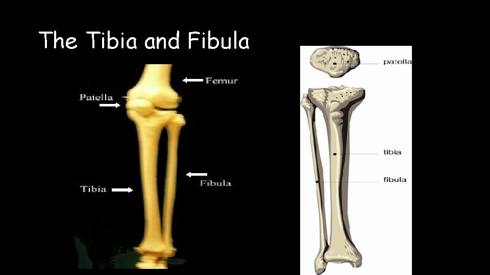 The Tibia and Fibula 