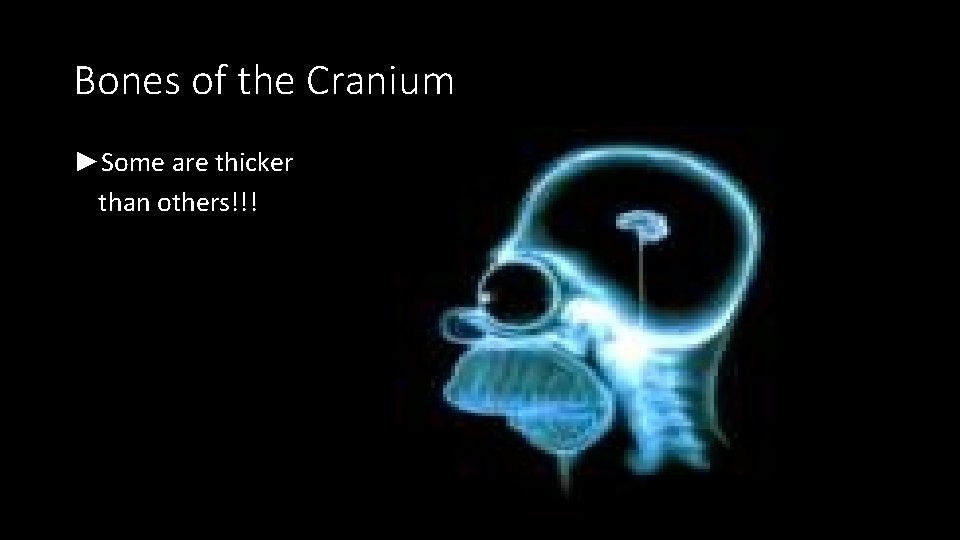 Bones of the Cranium ►Some are thicker than others!!! 