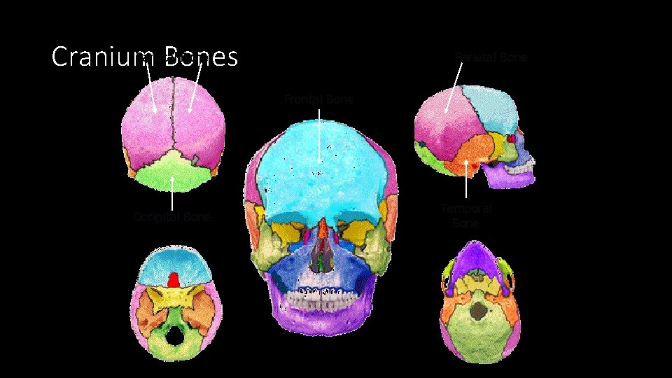 Parietal Bone Cranium Bones Parietal Bone Frontal Bone Occipital Bone Temporal Bone 